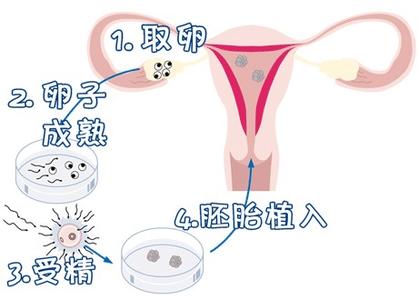 试管代妈公司代生生男孩